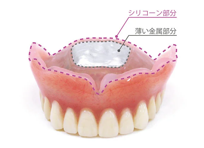 東京(綾瀬)の入れ歯専門外来、あやせ ほりきり中央歯科口腔機能クリニックのコンフォートデンチャー
