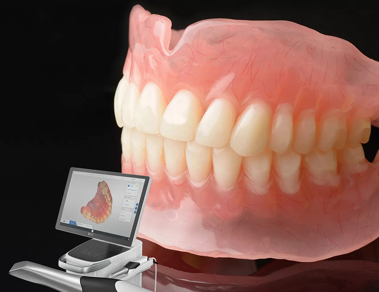 東京(綾瀬)の入れ歯専門外来、あやせ ほりきり中央歯科口腔機能クリニックの3Dプリントデンチャー「リーバ」